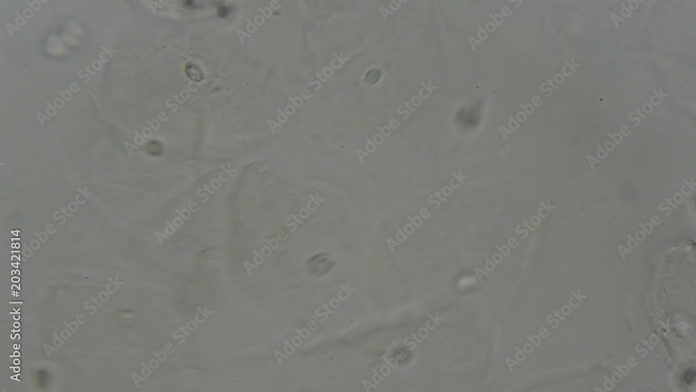 wet smear from vagina swab show epithelium cell , white blood cell and bacteria under microscope wet smear from vagina swab show epithelium cell , white blood cell and bacteria under microscope