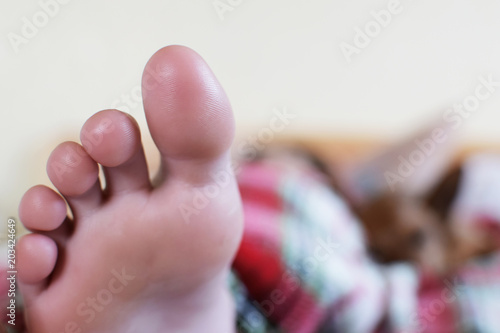 Teenage girl's foot on yellow blurred background with girl and dog at shallow depth of field with focus at fingers.