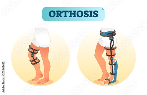 Human leg orthosis medical equipment vector illustration.