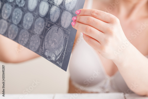 MRI brain scan photo in female hands photo