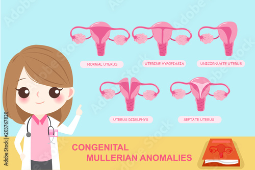 congenital mullerian anomalies