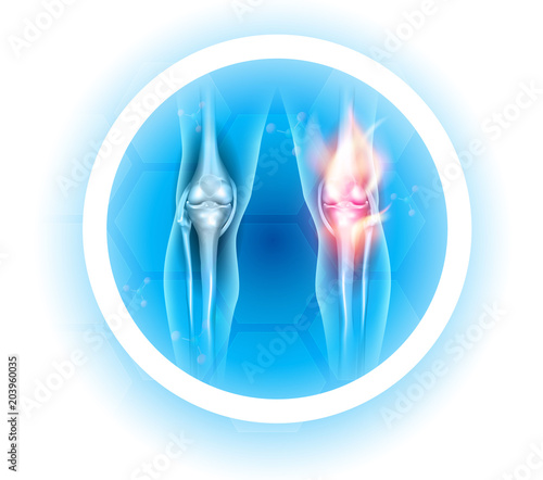 Joint problems symbol, transparent legs with joints on a beautiful light blue background