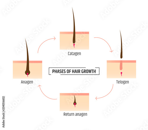 hair growth phases. Infographics trichology and dermatology. Laser Hair Removal