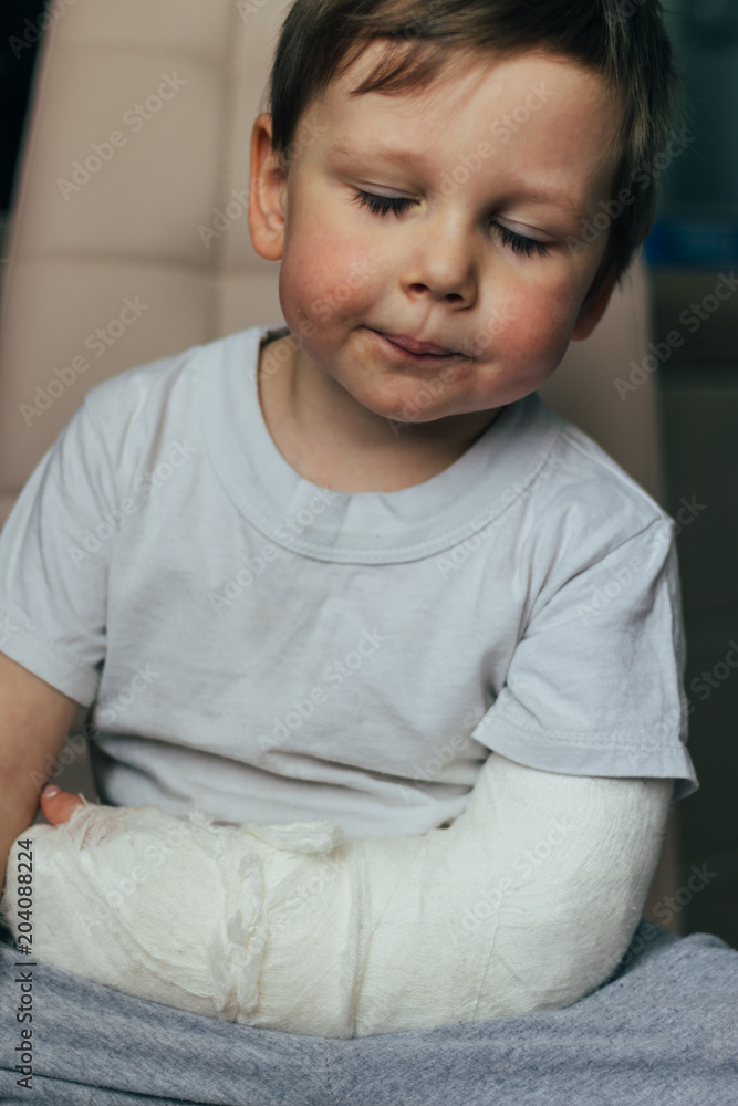 a small boy is sitting on a chair with a broken arm, in a cast. hospital. medicine. danger. pain. to break limbs. violence. a small boy is sitting on a chair with a broken arm, in a cast. hospital. medicine. danger. pain. to break limbs. violence.