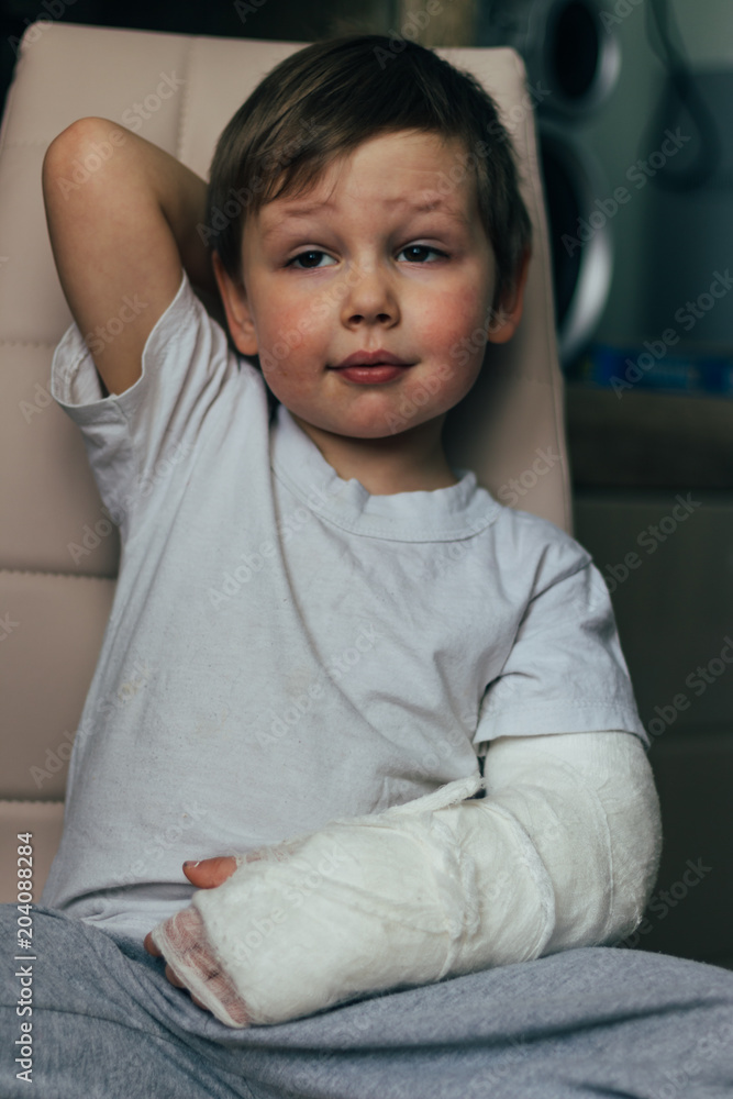 a small boy is sitting on a chair with a broken arm, in a cast. hospital. medicine. danger. pain. to break limbs. violence. a small boy is sitting on a chair with a broken arm, in a cast. hospital. medicine. danger. pain. to break limbs. violence.