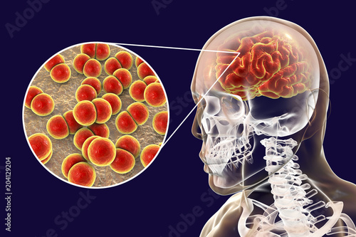 Brain infection with Neisseria meningitidis bacteria, 3D illustration. Gram-negative diplococci that cause meningitis and encephalitis