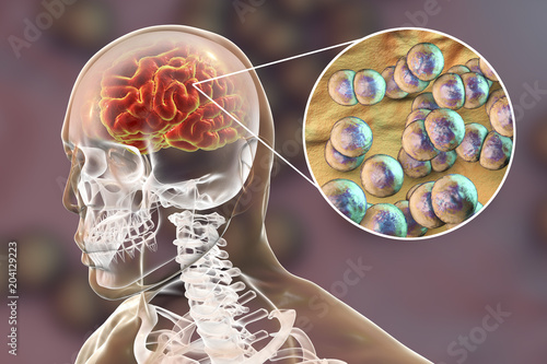 Brain infection with Neisseria meningitidis bacteria, 3D illustration. Gram-negative diplococci that cause meningitis and encephalitis