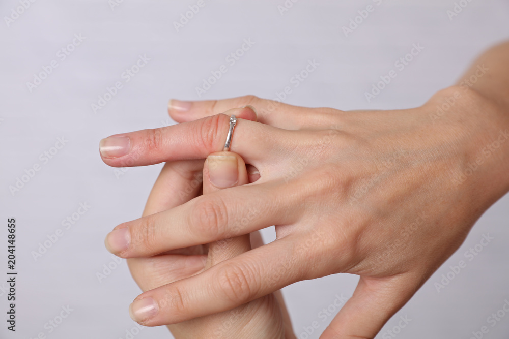 Swollen Hands. Woman traing to remove stuck ring off a swollen finger Swollen Hands. Woman traing to remove stuck ring off a swollen finger