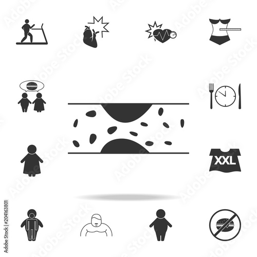 varicose veins  icon. Detailed set of obesity icons. Premium graphic design. One of the collection icons for websites, web design, mobile app