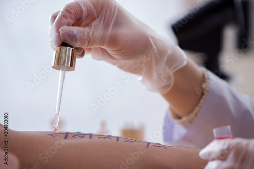 Doctor testing allergy reaction of patient in hospital photo