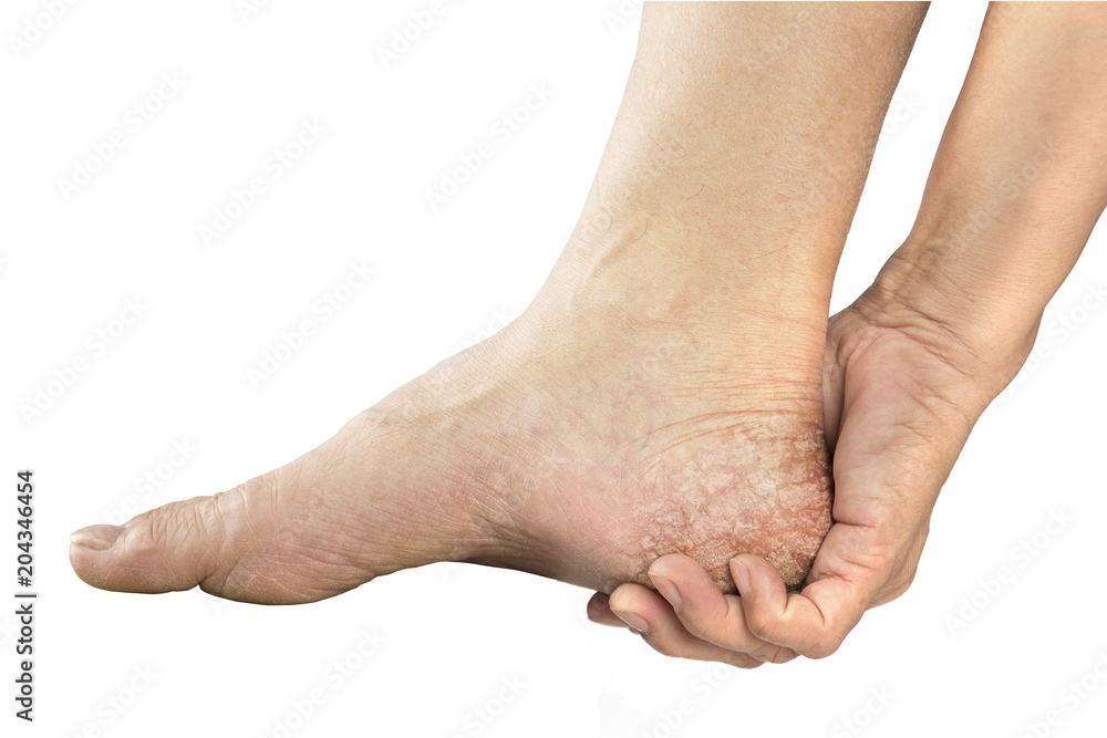 heel muscle pain heel muscle pain