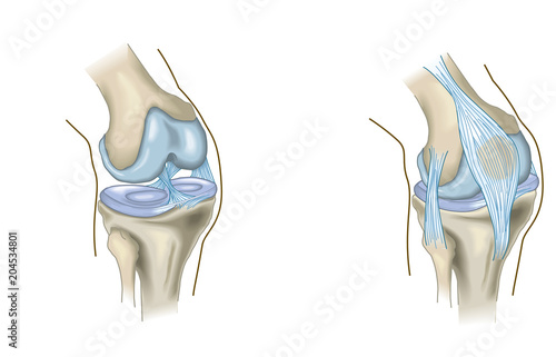Canvas Print The knee joint, anatomy, medical illustration
