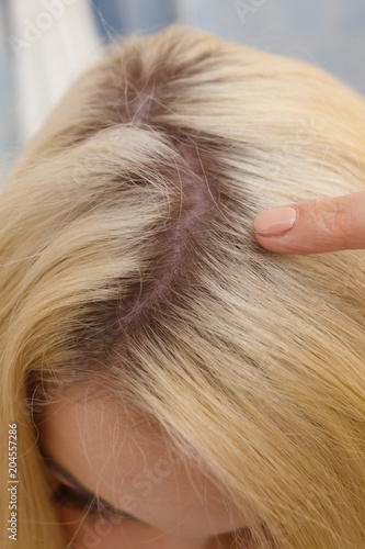 Woman showing blonde hair roots