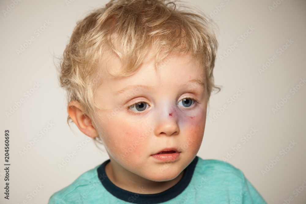 Schmerzen im Gesicht Schmerzen im Gesicht