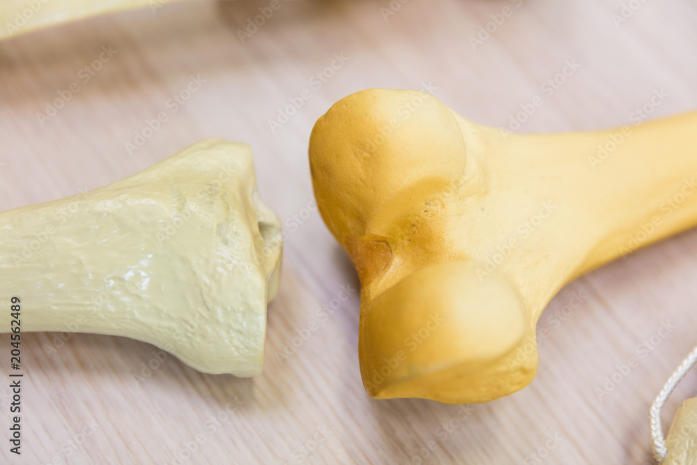 Künstliches Gelenk Künstliches Gelenk