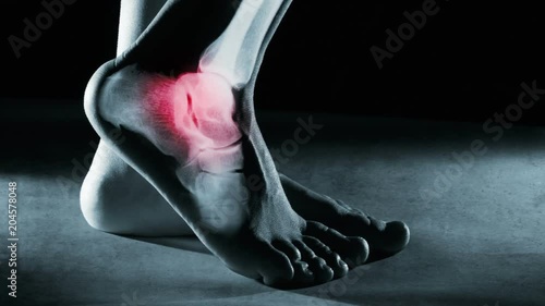 Human foot ankle and leg in x-ray with screen ripple and noise for electronic displays of medical equipment or pc tablet. The foot ankle is highlighted by red colour.