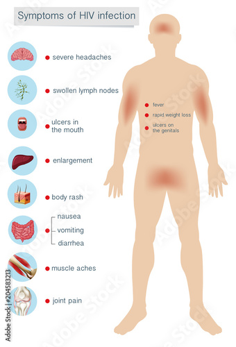Human Anatomy Symptoms of HIV Infection