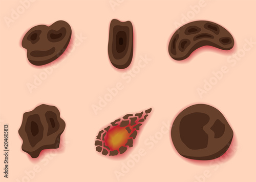 Tableau sur toile scab skin , wound , bleeding vector