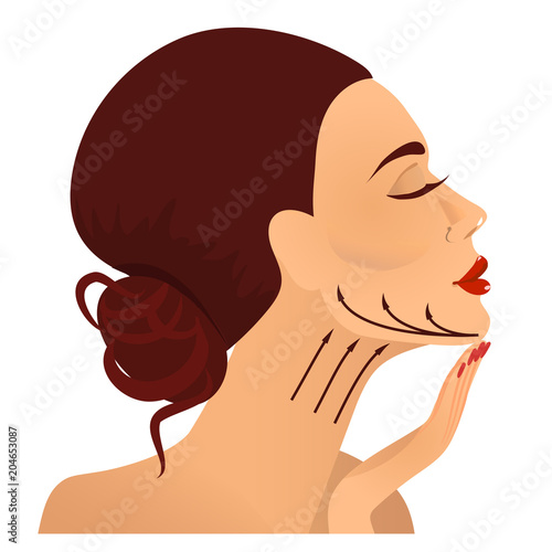 Chin lift