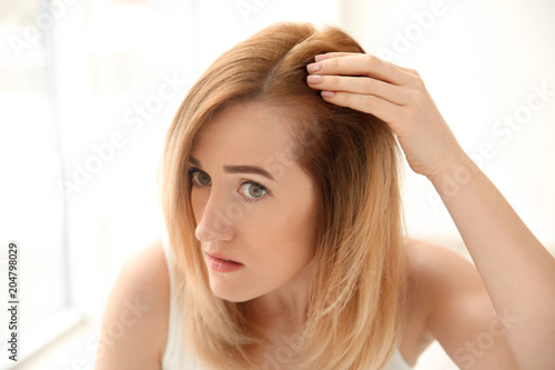 Young woman with hair loss problem on light background