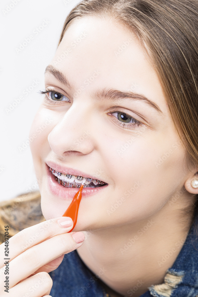 Dental Health Ideas and Concepts.Closeup Portrait of Caucasian Female Teenager With Teeth Braces. Cleaning Brackets Using Bristle Brush. Dental Health Ideas and Concepts.Closeup Portrait of Caucasian Female Teenager With Teeth Braces. Cleaning Brackets Using Bristle Brush.