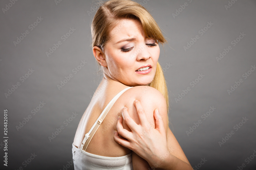 Fototapeta premium woman scratching her itchy arm with allergy rash