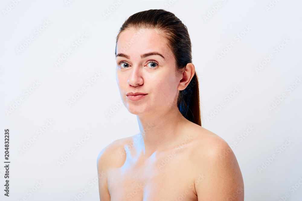 Allergic skin reaction on the female face Allergic skin reaction on the female face