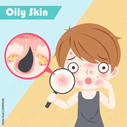 man with oily skin