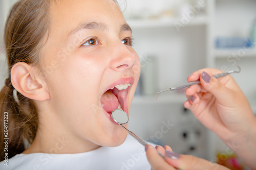Close-up of little girl opening his mouth wide during treating.