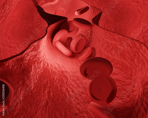 constricted blood vessels c...