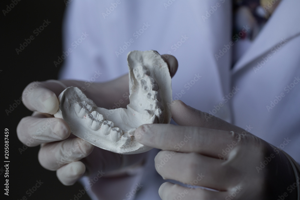 Study cast of Diagnostic cast and dental gypsum models in dental