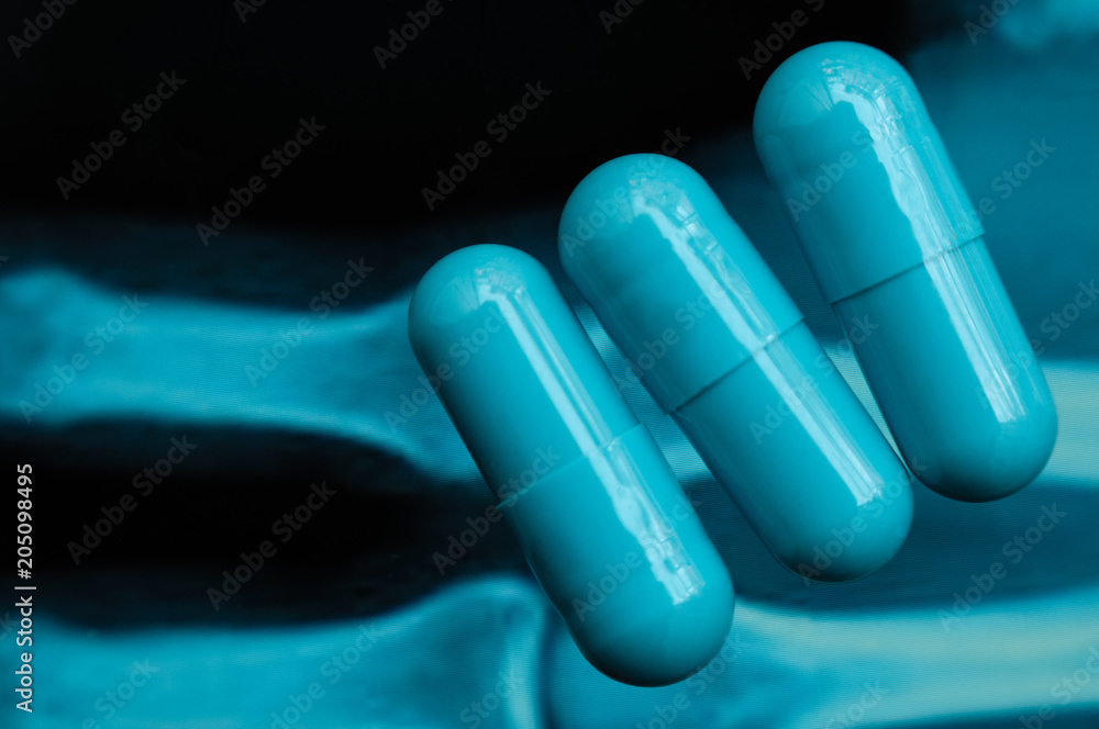 Three blue medicine capsules disposed on a x-ray sheet with bones imagine,  isolated on black Stock Photo | Adobe Stock
