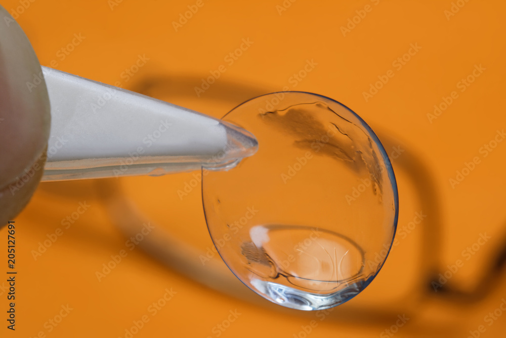 A soft contact lens is clamped by the tweezers close-up