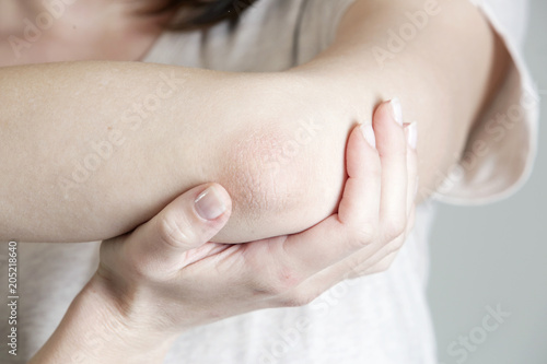 Photography Winterizing dry itchy skin on the elbow area