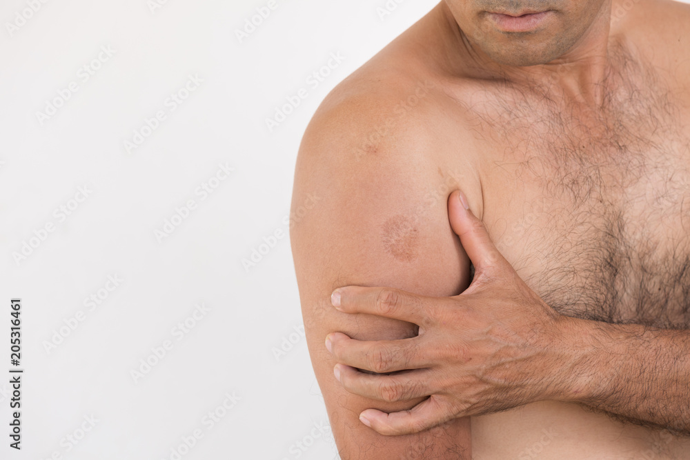 Closeup man elbow and arm pain and injury on white background. Health care and medical concept. Closeup man elbow and arm pain and injury on white background. Health care and medical concept.