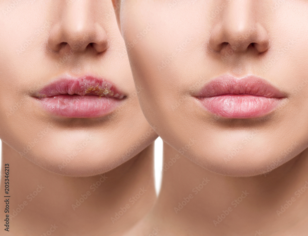 Diseases of the Female Reproductive System Clinical Gate