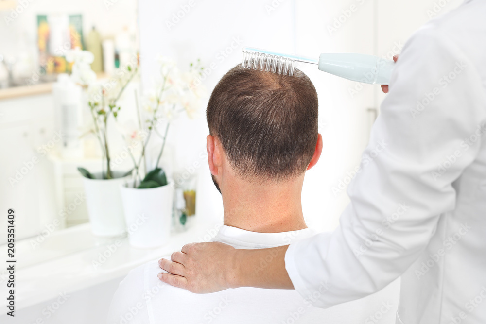 Mezoterapia tlenowa skóry głowy. Głowa mężczyzny z przerzedzonymi włosami podczas zabiegu pielęgnacyjnego Mezoterapia tlenowa skóry głowy. Głowa mężczyzny z przerzedzonymi włosami podczas zabiegu pielęgnacyjnego