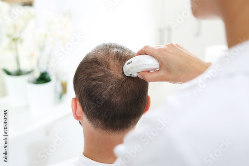 Badanie trychologiczne. Głowa mężczyzny z przerzedzonymi włosami podczas badania skóry głowy i włosów mikroskopem