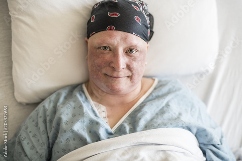 woman in hospital bed suffering from cancer photo