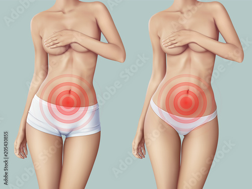 Slim woman suffering from abdominal pain. The slim woman's body and symbol of pain that can by used for indicate some kind of pain in any places on body. realistic vector illustration