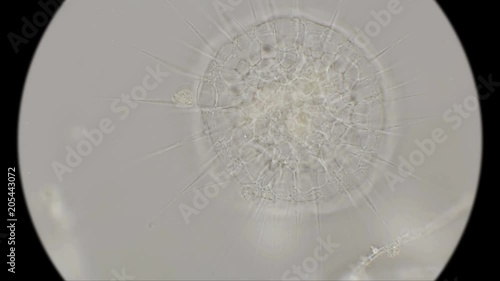 the simplest organisms of the Heliozoa class, similar to radiolarians, under a microscope photo