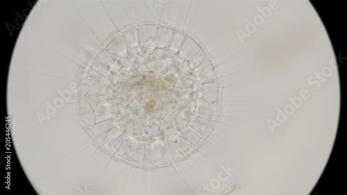 the simplest organisms of the Heliozoa class, similar to radiolarians, under a microscope photo