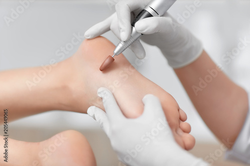 Podiatrist using special grinding equipment and making procedure polish.