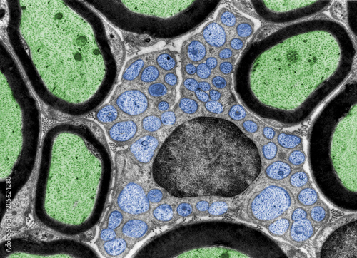 Nerve fibers. TEM photo