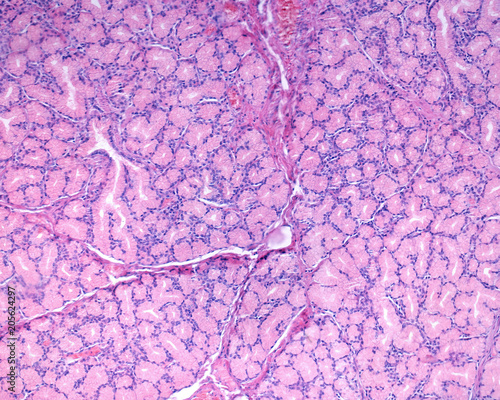 Duodenum. Brunner’s glands photo