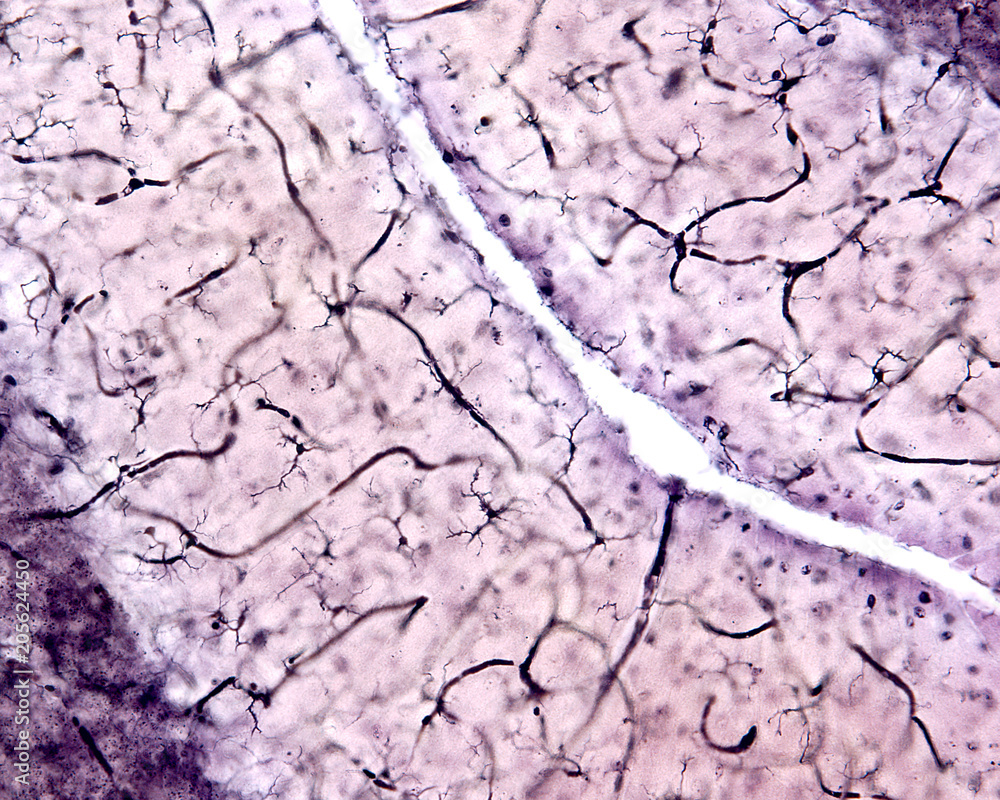 Fototapeta premium Microglia. Cerebellar cortex