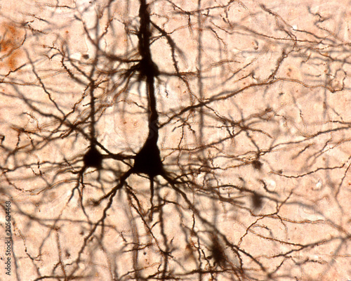 фотографія Pyramidal cell. Cerebral cortex