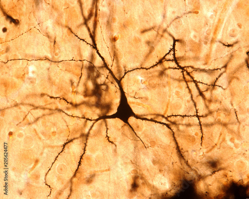 фотографія Pyramidal cell. Cerebral cortex
