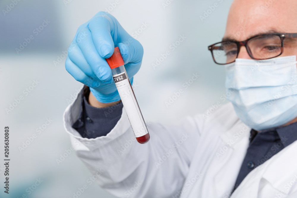Ein Arzt mit Mundschutz hält eine Blutprobe in der Hand Ein Arzt mit Mundschutz hält eine Blutprobe in der Hand
