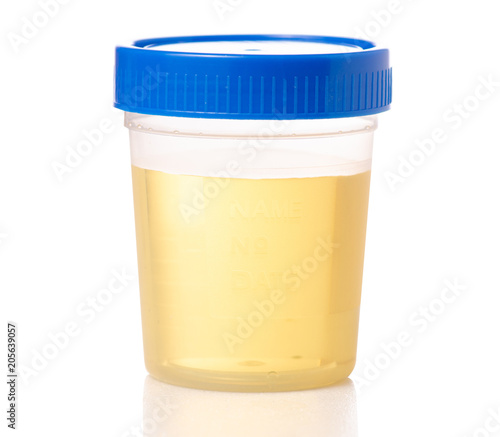 Plastic container with urine analysis on white background isolation